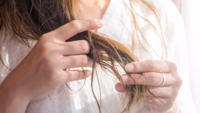 Do You Notice More Hair Loss in Winter? Here’s Why